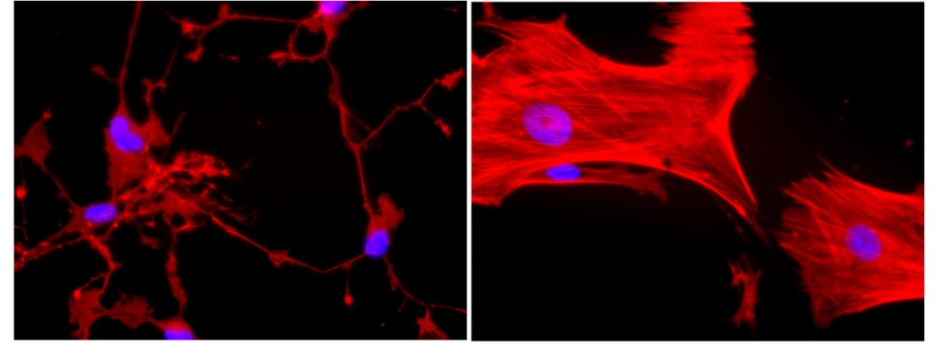 Estudo aponta que células-tronco de pacientes com autismo apresentam desregulação de mecanismo importante para formação de neurônios